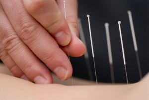 acupuncturist-job-description