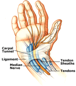 carpaltunnel