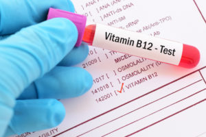 b12 test