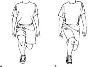 Correct and incorrect single squat test