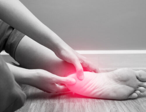 Plantar Fasciitis: The Stretching Routine To Be Pain Free